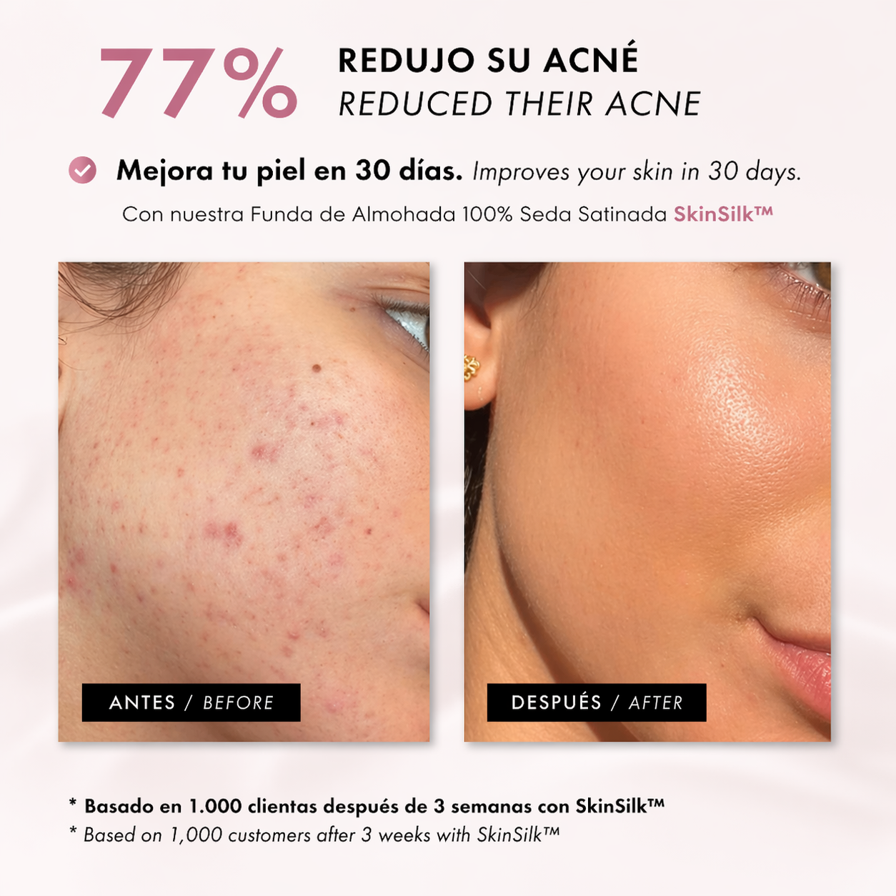 SkinSilk™ - Cabello cuidado, piel suave
